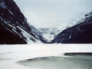 Lake Louise 1